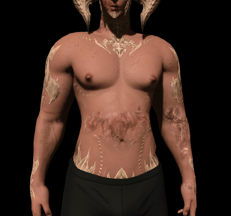 burns &amp; slashing wound scarring